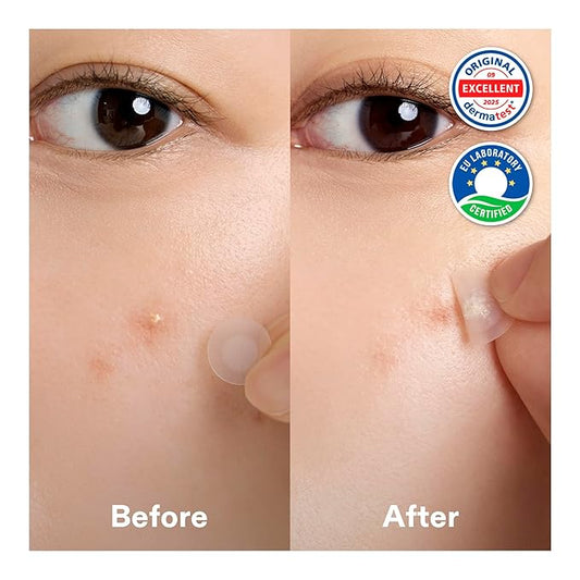 Cordiale Centella Pimple Patches with Salicylic Acid & Hyaluronic Acid, Hydrocolloid Acne Spot Patches for Face & Chin, Invisible Zit/Blemish Stickers, Korean Skin Care (78 Count, 2 Sizes)