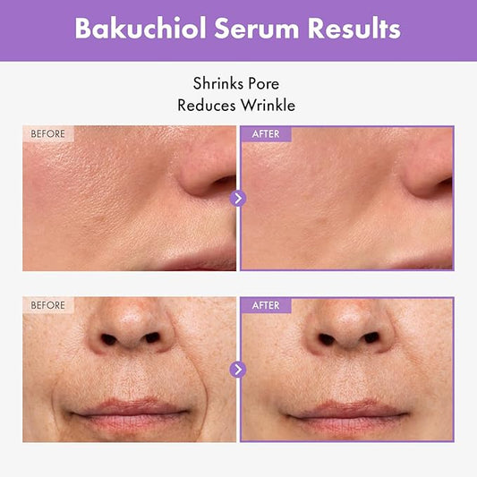 TOSOWOONG Bakuchiol Serum, 5,000ppm Bakuchiol, Anti-Aging, Pore Minimizer for Face, Hydrating Glow Serum, Facial Moisturizer, Active Skin Repair, Glass Skin, Korean Skincare, 30ml, 1.01 fl. oz.