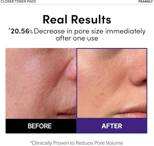 FRANKLY Pore Closer Toner Pads l Rice Jelly Pads with 9 Peptides, Vegan Collagen, Rice Extract l Pore Minimizer l Hydrating for All Skin Types l Korean Skin Care | 70 Count