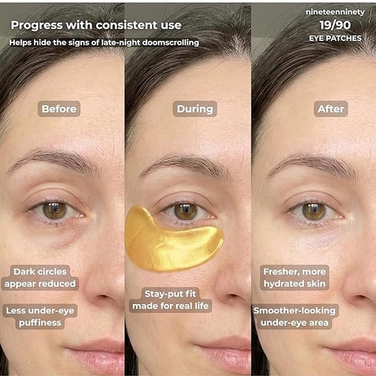 19/90 Under Eye Patches for Dark Circles & Puffiness – Hydrogel Eye Masks with Caffeine, Niacinamide & Collagen – Helps Reduce the Look of Bags & Fine Lines, Gold, (30 Pairs)