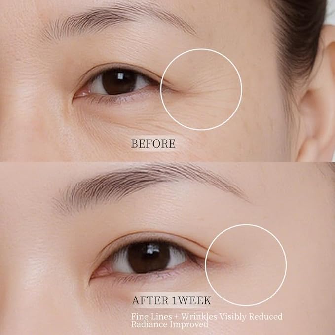 5% PDRN Eye Cream Clay Mask, DIY Under Eye Patches for Puffy eyes, Dark Circles & Wrinkle Custom Fit on All Face | Caffeine, Retinol, Collengen, Peptides, Hyaluronic - Korean Popular EyeCare - 1.06OZ