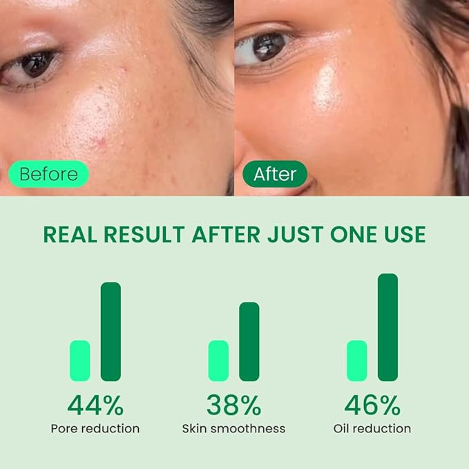 QUIA Korean Skincare Duo - Toner Pads + Hydrogel Eye Patches - Complete Facial Hydration System - Refine Texture, Depuff & Smooth Fine Lines - No-Slip Formula for Refreshed, Radiant Skin