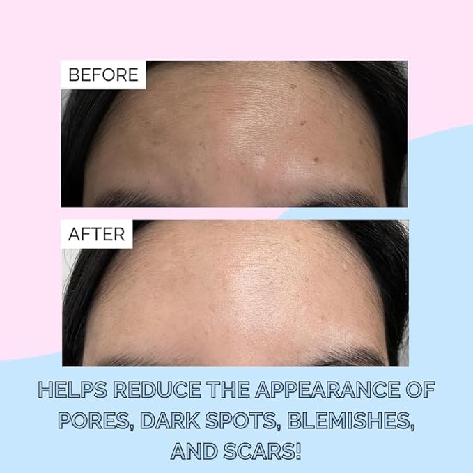 Elizabeth Mott Korean Snail Mucin Serum - 97% Snail Secretion Filtrate for Deep Hydration & Glass Skin - Lightweight, Fast-Absorbing, Cruelty-Free, 100 mL