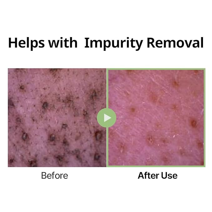 DINSEE Premium Vegan Low pH Hyaluronic Acid Foam Cleanser- Non-Stripping Daily Face Wash For All Skin Types, Gentle Korean Face Cleansing Foam, Low pH, 50ml/ 5.07 fl oz