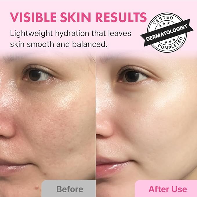 Hanskin Hyaluron Skin Essence Toner – Korean Hydrating Toner for Glass Skin | Hyaluronic Acid & Collagen | Lightweight Moisturizing Astringent for Dry, Sensitive & Dull Skin | K-Beauty (5.07 fl oz)