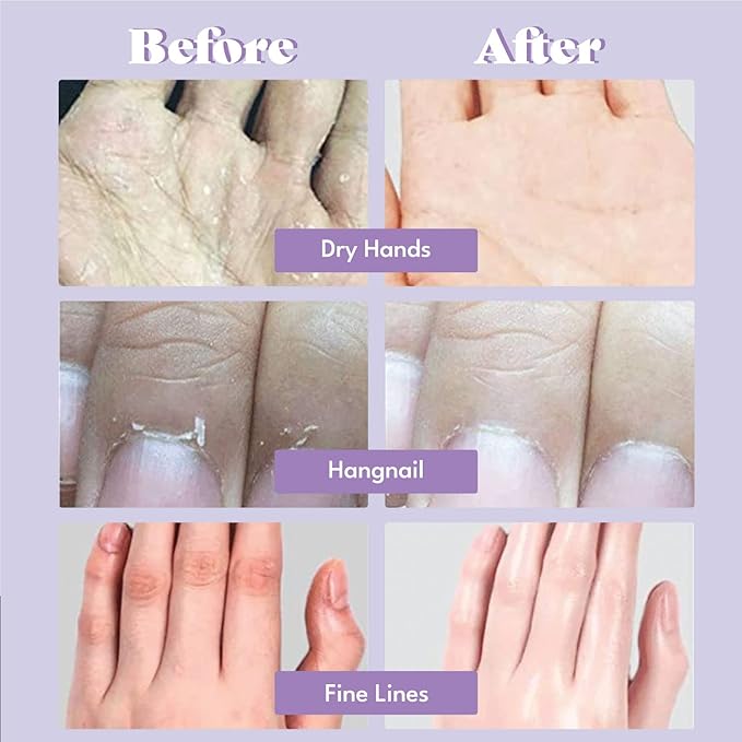 Extra Silky Hand Mask 5 Pairs, Korean Moisturizing Gloves for Dry Hands with White Truffle, Green Caviar & Peptides, Repairing Hand Care Treatment for Aging, Cracked, and Dry Skin