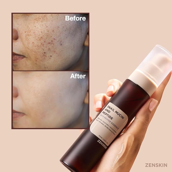 Snail Mucin Essence, Korean Hydrating Serum with Snail Mucin, Hyaluronic Acid, and Skin Revitalizing Ingredients for Smooth Skin, 100ml