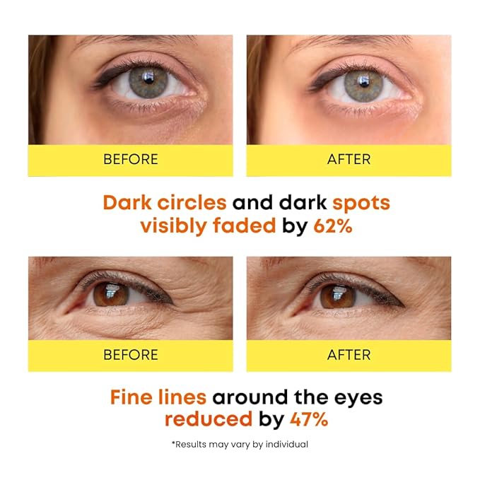 360° Vitamin C Eye Masks – Korean Under Eye Patches for Puffy Eyes & Dark Circles, Lifting Eye Tone Up with Niacinamide & Bakuchiol, Hydrating and Soothing 50 Masks