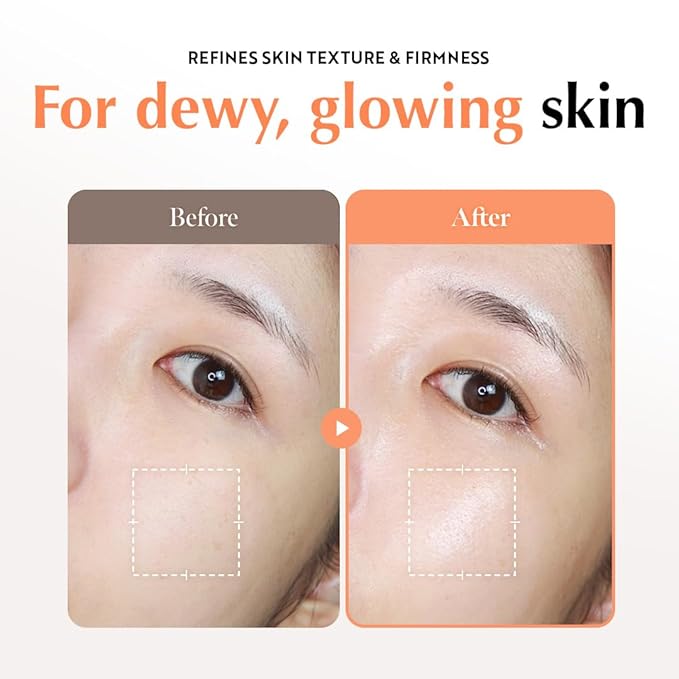 UIQ Biome Barrier Cream Mist - Facial Barrier Mist for Hydration & Skin Barrier Repair, Microbiome-Based Korean Skin Care, 3.38 fl oz