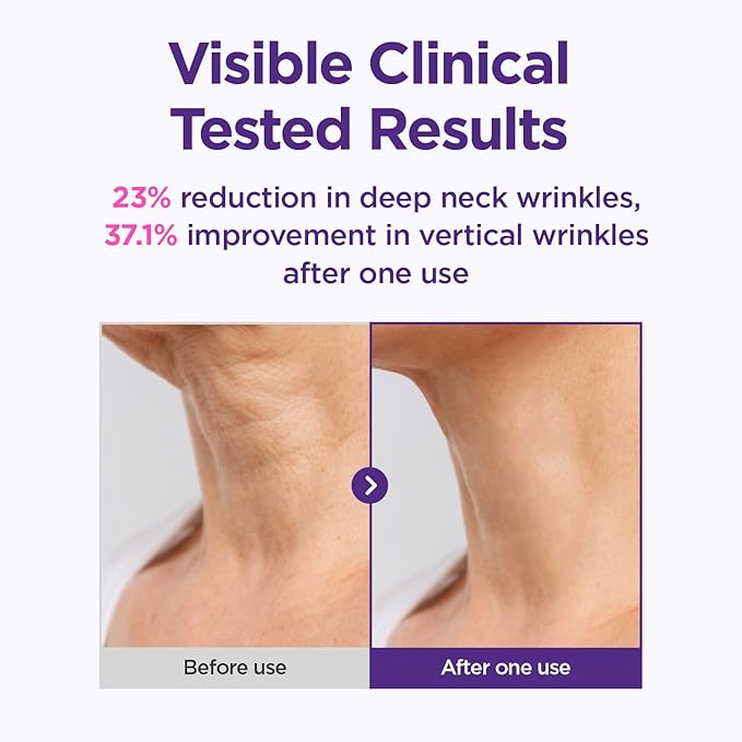 CKD Gua Sha Neck Cream Filltocshot - Advanced Anti-Aging Neck Firming Cream with Massage Roller. Visibly Reduces Wrinkles, Lifts & Tightens Sagging Skin, Boosts Elasticity, Korean Skincare, 1.69 fl oz