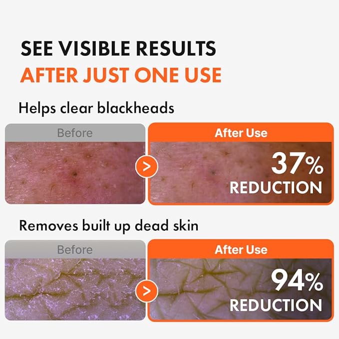 Hanskin AHA Pore Cleansing Oil for Dry Skin, Exfoliating, Waterproof Makeup Sebum Remover Facial Oil Cleanser for Face, Moisturizing for Soft Skin, Korean Skincare [AHA/10.14 oz.]