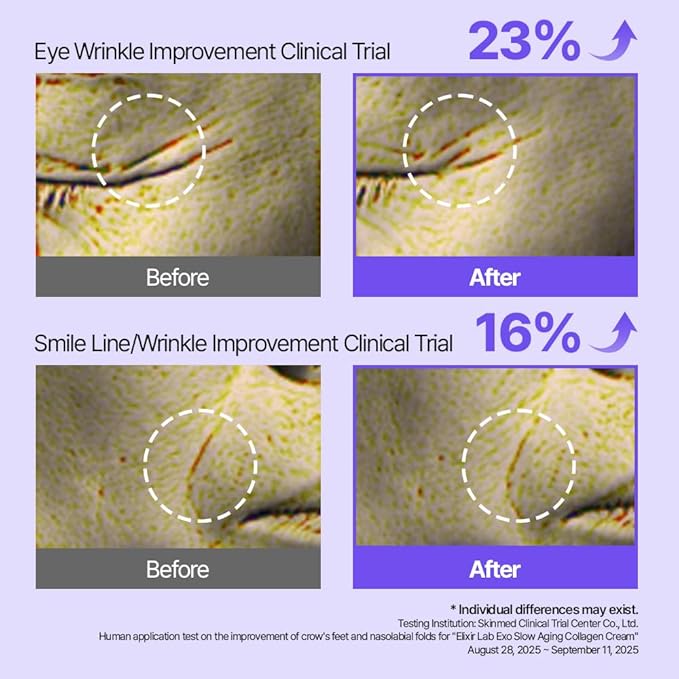 Korean Collagen Cream (73.3%) | Advanced Firming Moisturizer with Peptides & EGF for Face, Eyes, & Smile Lines | Reduces Appearance of Wrinkles, K-Beauty, 1.76 oz