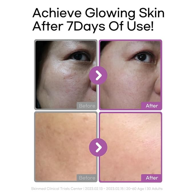 daymellow Galactomy Bakuchiol Serum 1.01fl.oz/30ml, Retinol Face Serum, Niacinamide 2%, Panthenol, Collagen, Wrinkle Care, for Sensitive Skin, Daily Anti-Aging Facial Serum Korean Skincare