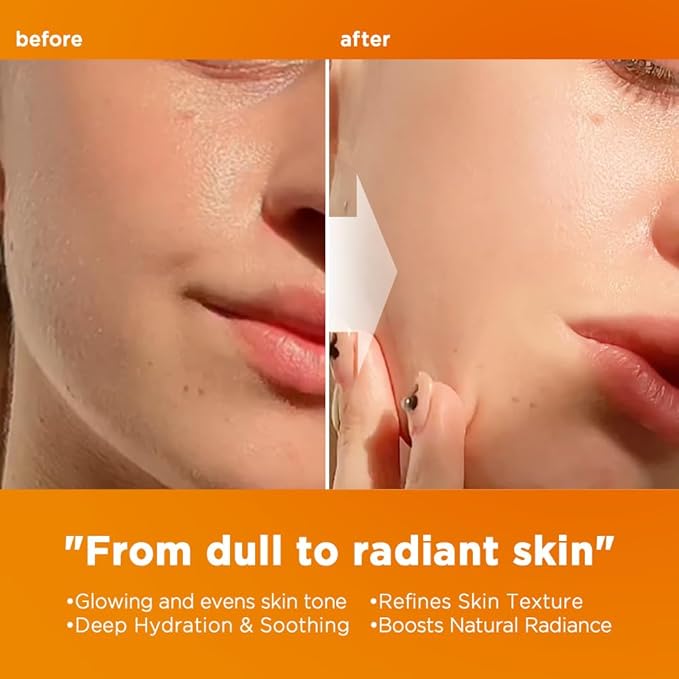 Nightingale C Toning Sleeping Mask, Overnight face Mask For Face, Vitamin C + Niacinamide +AHA, BHA, PHA+ Hyaluronic Acid, Moisturizing & Visibly Brighten, Korean Skin Care