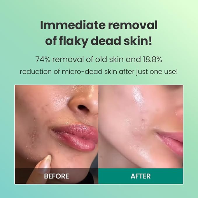 Dr. G Brightening Peeling Gel - Korean Skincare for Glowy Skin - Aqua Gommage Facial Exfoliator - Hyaluronic Acid, Ceramides, Vitamin C - Smooth Skin Texture, Low Irritation - Bulk Items - 4.23 fl oz