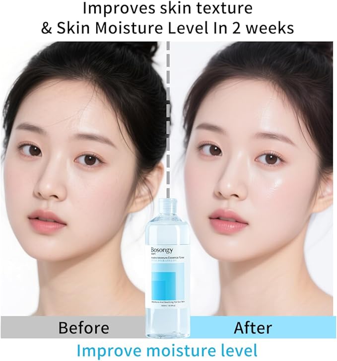 Hydro Moisture Essence Toner 500ml(16.9fl.oz.) – Deep Nourishing Facial Toner for Dry & Sensitive Skin, Infused with Hyaluronic Acid, Panthenol &Azelaic Acid Korean Skincare