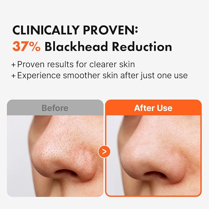 Hanskin AHA Pore Cleansing Oil for Dry Skin, Exfoliating, Waterproof Makeup Sebum Remover Facial Oil Cleanser for Face, Moisturizing for Soft Skin, Korean Skincare [AHA/10.14 oz.]