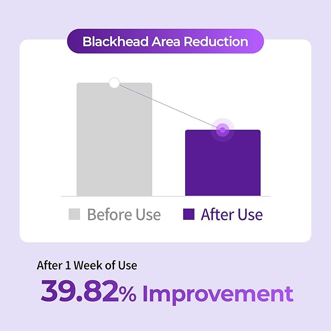 BENTON Guava Pore Cleansing Oil – Korean Facial Cleanser with Enzymes & Plant Oils for Blackhead Removal, Makeup Remover & Deep Pore Cleansing – Lightweight, Non-Greasy – 6.76 fl oz (200ml)