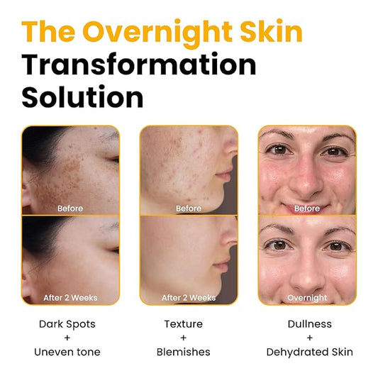 QUIA Collagen Jelly Cream + Turmeric Overnight Wrapping Mask – Daily Hydration and Night Repair Skincare Set – Korean Skincare Moisturizer + Sleeping Mask