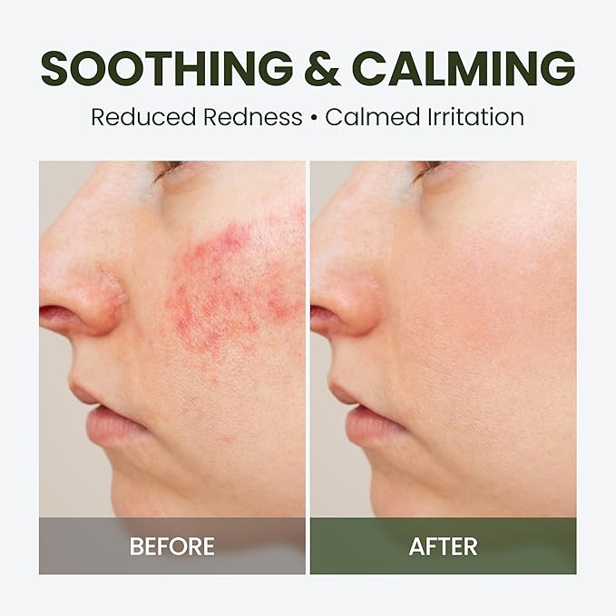 HyCicaMue Toner Pad(80 Pads) | Multi-Layer Hydration & Soothing for Redness | 7 Types of CICA, Vegan Mucin, Hyaluronic Acid | Removes Dead Skin Cells & Smooth, Clear Skin | Korean Skin Care