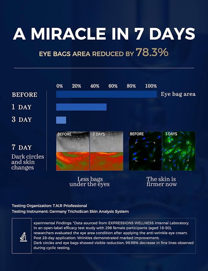 Retinol Eye Cream for Dark Circles with Caffeine Peptides Niacinamide Tranexamic Acid, Under Eye Cream for Puffiness and Eye Bags, Hydrating Firming Korean Eye Care 1.06 oz Silver