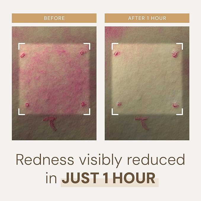 Rice Pure Barrier Capsule Cream - Moisturizing & Skin Barrier Cream | Hypoallergenic, Dermatologist Tested | Korean Skincare with Ceramide Capsules & Korean Rice Extract