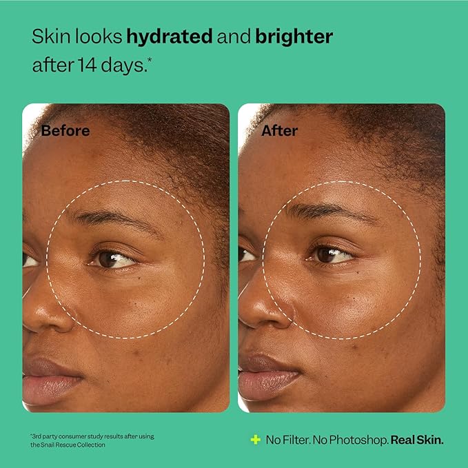 Peach Slices - Snail Rescue All-in-One Deep Moisture Cream (2.82 oz) - Snail Mucin - Intensive Hydration, Soft Skin - Squalane, Hyaluronic Acid & Cica - Vegan, Cruelty Free, Korean Skin Care & Beauty