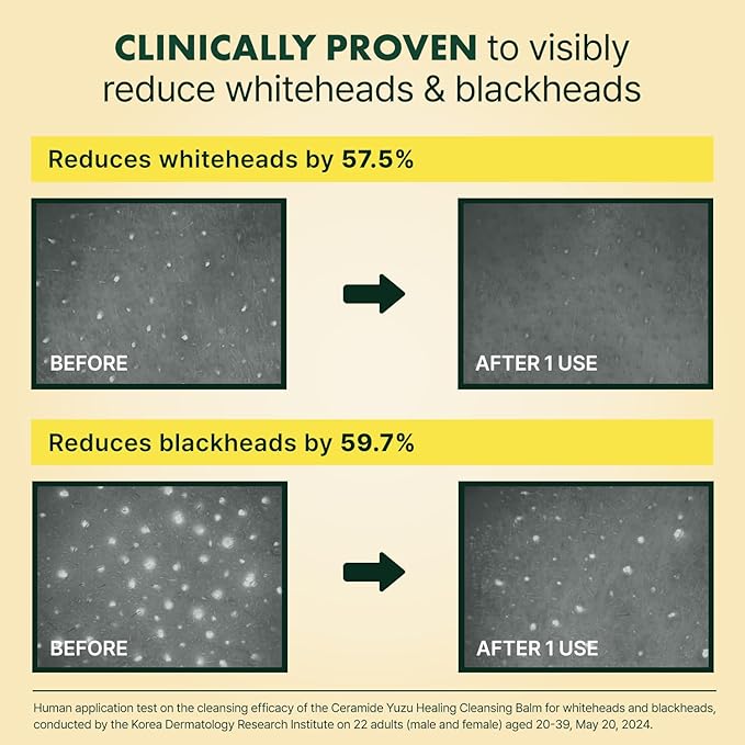 Ceramide Yuja Makeup Cleansing Balm with Travel Size | Deep Cleansing All-in-One Korean Face Cleanser, Makeup Remover, Zero Irritation, Blackheads Remover, Clean Beauty, Vegan (135g / 4.76oz)