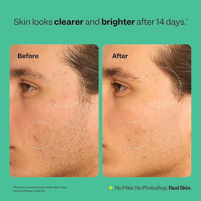 Peach Slices - Snail Rescue Blemish Busting Toner (4.05 oz) - 95% Snail Mucin Concentrate - Clarify, Strengthen, Balance - Hyaluronic Acid & CICA - Vegan & Cruelty Free - Korean Skin Care & Beauty