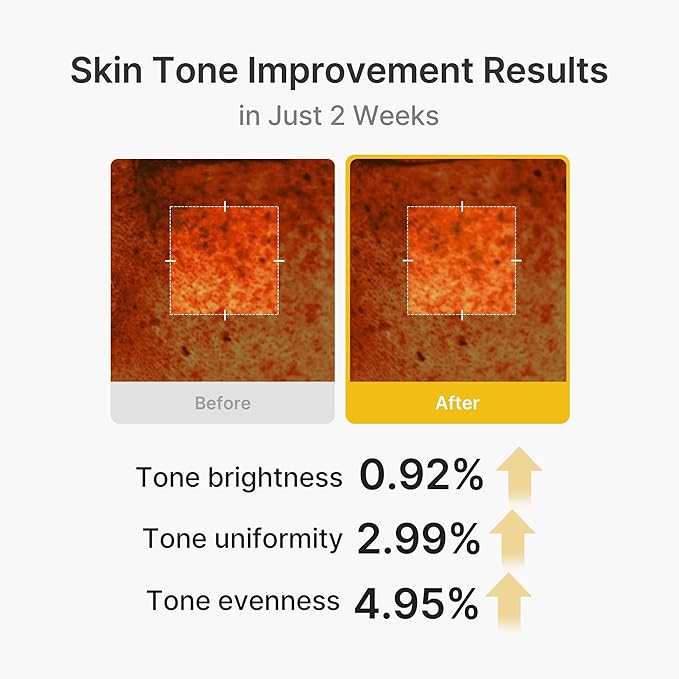 medicube Capsule Cream with Kojic Acid & Turmeric for Uneven Skin Tone | Tone Renewal & Radiance Care for troubled skin | Turmeric, Kojic, Vitamin C | Korean Skincare, 1.86 oz