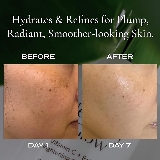 Korean Bakuchiol Serum + Niacinamide & Vitamin C | Plumping | Retinol Alternative | Firming | Brightening | Fine Lines | Uneven Tone (WYLYS)