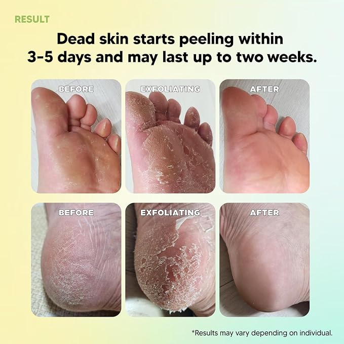 Foot Exfoliation Peeling MASK, Baby Foot Peel, Cracked Feet, Callus Remover, Korean Footcare
