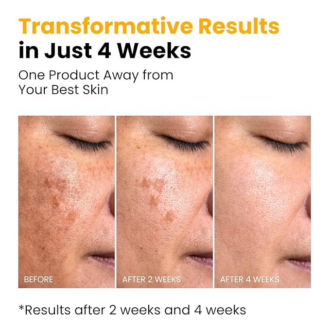 QUIA Collagen Jelly Cream + Turmeric Overnight Wrapping Mask – Daily Hydration and Night Repair Skincare Set – Korean Skincare Moisturizer + Sleeping Mask