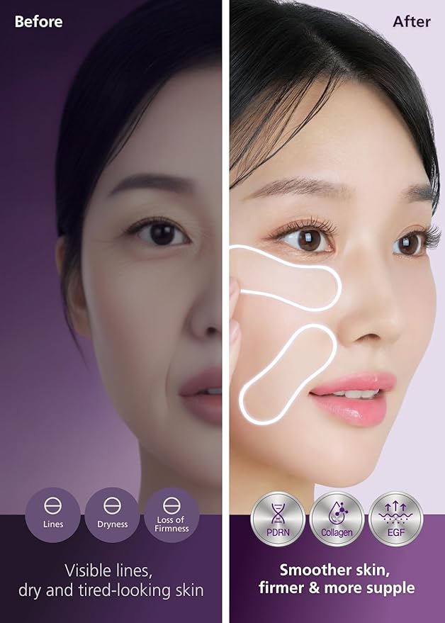 Easyderm PDRN Anti-Wrinkle Patch - Under Eye & Smile Line treatment, 8 Patches, K-Beauty Korean Skincare with Collagen & EGF, Eye patches, PDRN Eye Mask