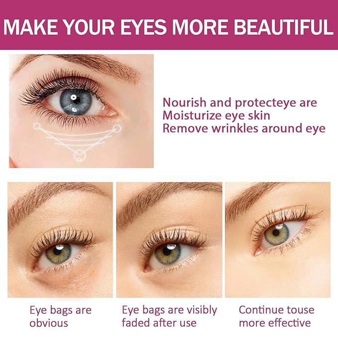 Calcium Multi Balm, Calcium Volume Multi Balm, Wrinkle Core Stick, Korean Collagen Moisturing Stick, Anti-aging, Hydrating, Reduce fine lines, Suitable for Eyes, Neck, Face