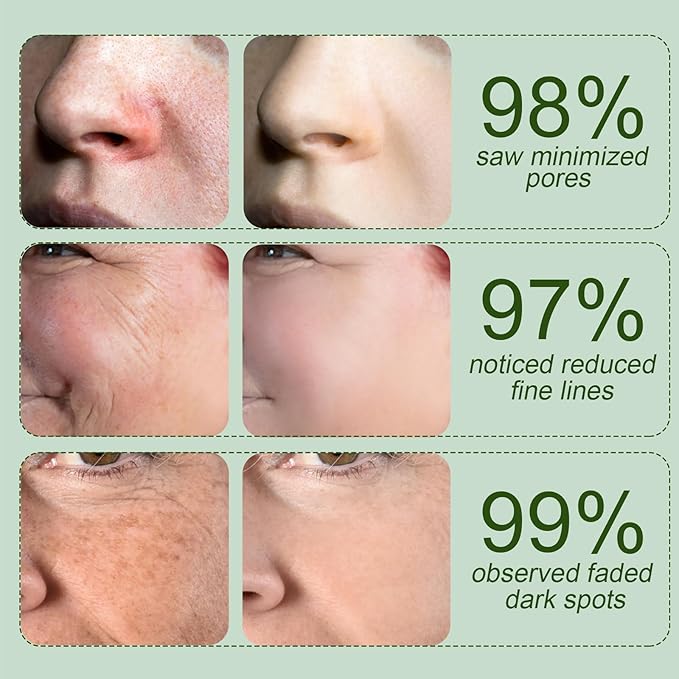 Korean Skin Care Toner Pads Snail Mucin Toning Polish Pads - Facial Skincare for Dark Spots, Wrinkles & Dull Skin - Hydrating Facial Treatment - 100 Count