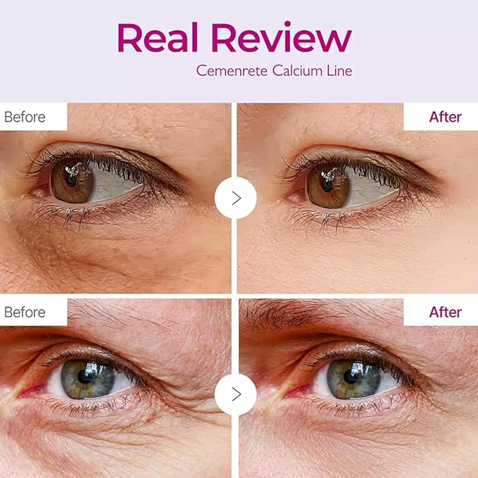 2Pcs Calcium Multi Balm Anti-Aging Face Cream, Korean Collagen Anti Wrinkle Stick, Wrinkle Core Stick, Hydrating, Firming Skin, Suitable for Eyes, Neck, Face