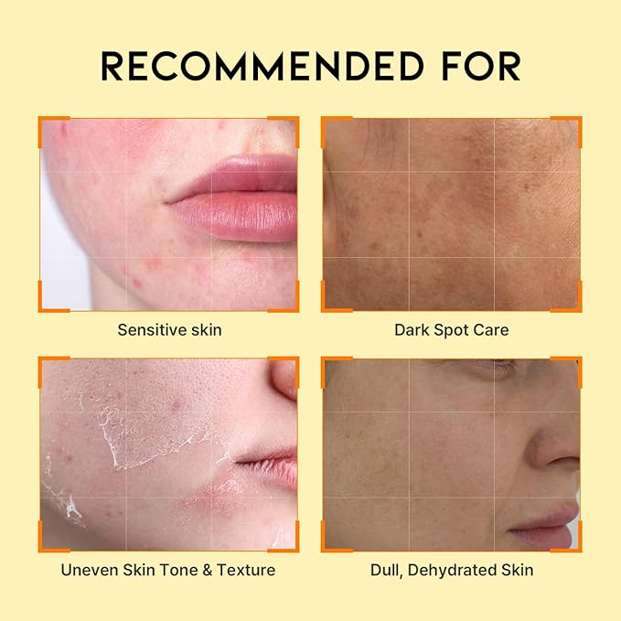 Korean Vitamin C Serum for Brightening and Glowing Skin with Ascorbic Acid & Vitamin Tree Water, Facial Serum 1.69 Fl Oz