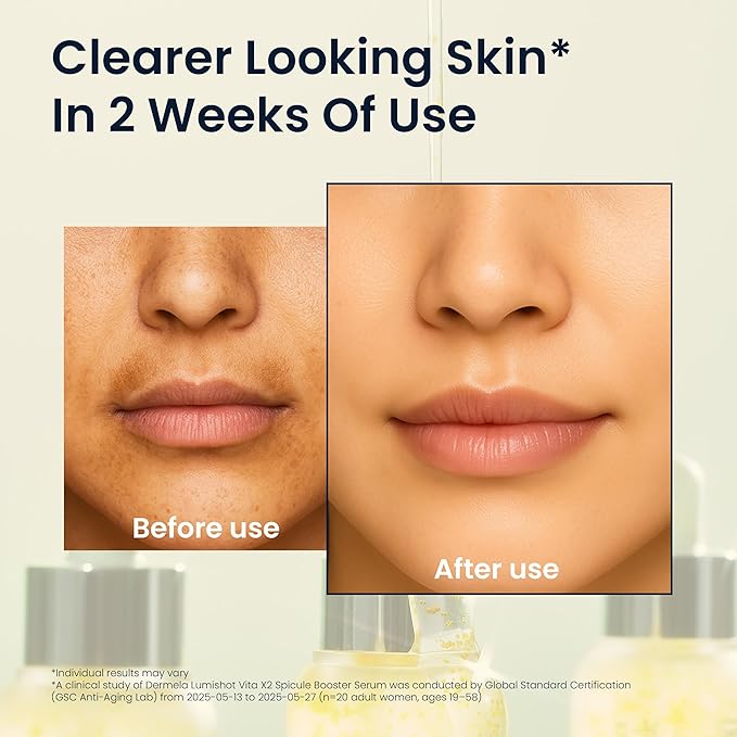 Lumishot Vita X2 Spicule Booster Serum, Vegan Spicules with Vitamin C + Niacinamide, Glutathione & Panthenol, Brightening & Texture Care 1.01 fl oz (30ml) | Korean Face Serum for Uneven Tone