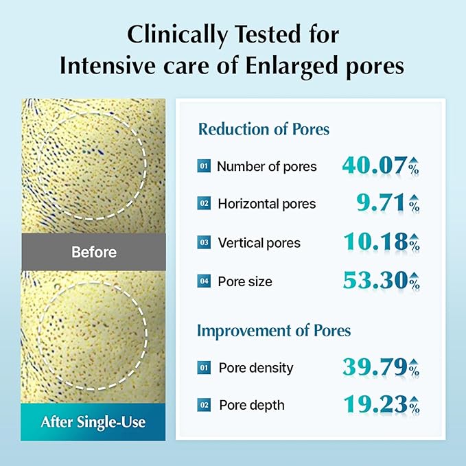UIQ Biome Remedy Pore Reset Cooling Pad, Hydrating & Cooling Korean Toner Pads, Instant Cooling for Dry, Overheated skin, Pore Care with Panthenol, Allantoin, Niacinamide 80 Pads, 6.08 fl. oz.