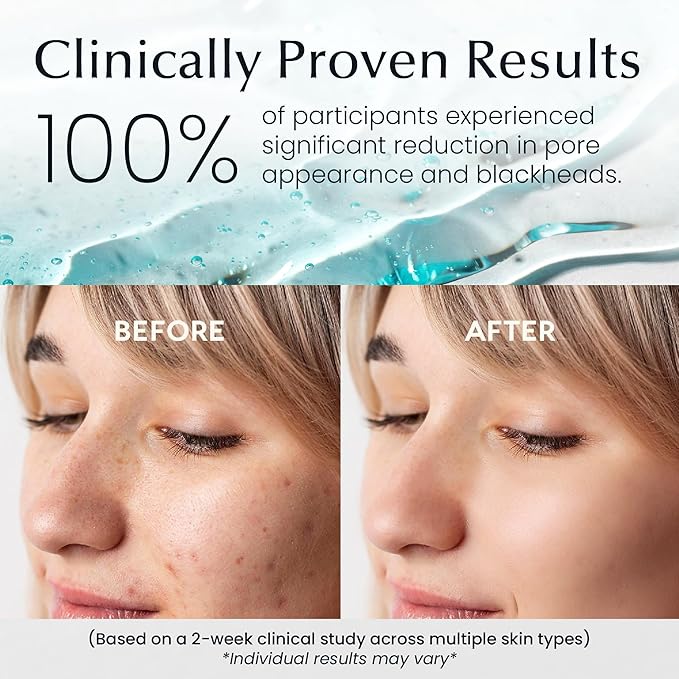 La Pure Korean Toner Pads, Large, 100 Ct, with Witch Hazel, Centella Asiatica & Niacinamide, Alcohol-Free, Gentle Exfoliating Pore & Dark Spot Care