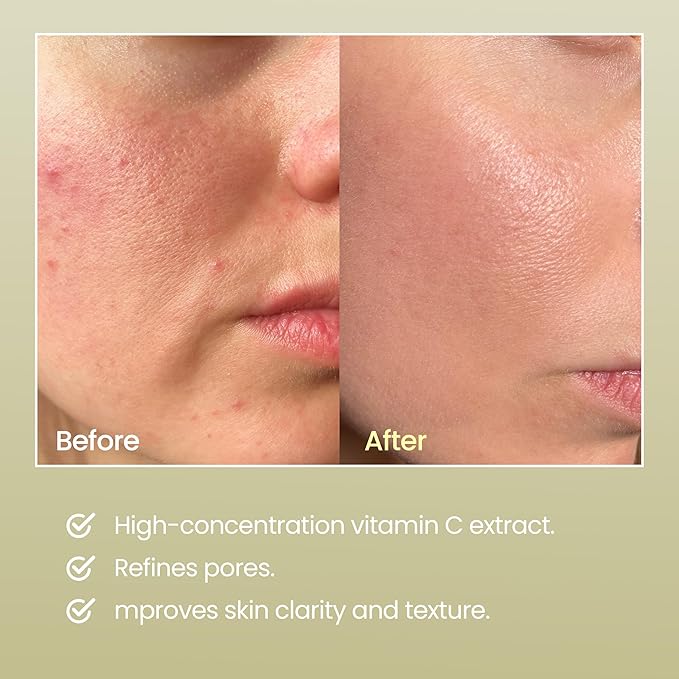 DERMALOGY by NEOGEN Real Vitamin C Serum 1.12 oz (32g) - Brightening, Revitalizing Serum with 22% Pure Ascorbic Acid, Ferulic Acid, Zinc and Niacinamide - Korean Skin Care