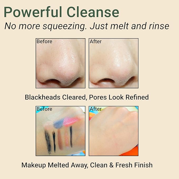 Pore Purifying Cleansing Oil – Korean Face Wash with Centella, Tea Tree, Green Tea & LHA – Gentle Makeup Remover for Sensitive, Acne-Prone Skin, Deep Pore Cleanser, 6.76 fl oz