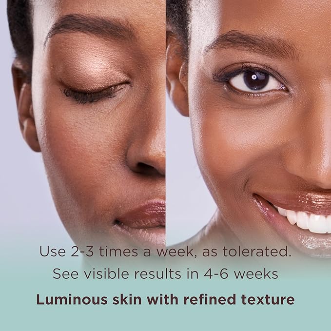 MATKAS Korean Exfoliating Witch Hazel Toning Pads - 60 pcs, Korean Skin Care Glycolic Acid Toner Pads, AHA BHA Gentle Face Exfoliator, Facial Acid Peel for Dark Spots, K Beauty Pore Minimizer for Face