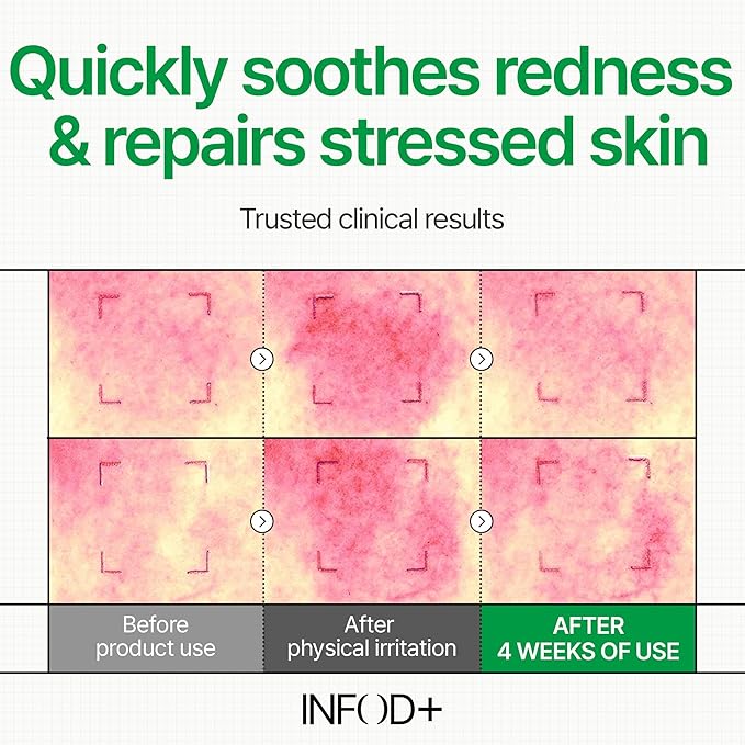 INFODPLUS Korean Skin Care Sensitive Face Cream, Fragrance-Free Lightweight Moisturizer with Ceramides & Panthenol, Skin Barrier Support & Deep Hydration, Low pH Daily Cream for AM/PM Use, 50ml