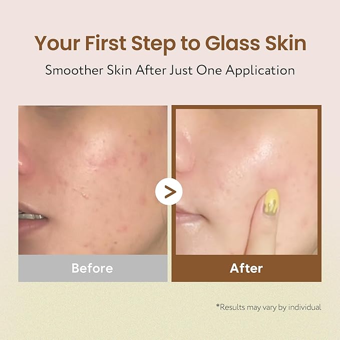 Coconut Rice Milk Toner | Calming Hydration, Smooth Skin Texture and Strengthen Skin Barrier with Rice, Panthenol, Ceramide, AHA | Fragrance-Free, Korean Skin Care (150ml/ 5.07 fl oz)