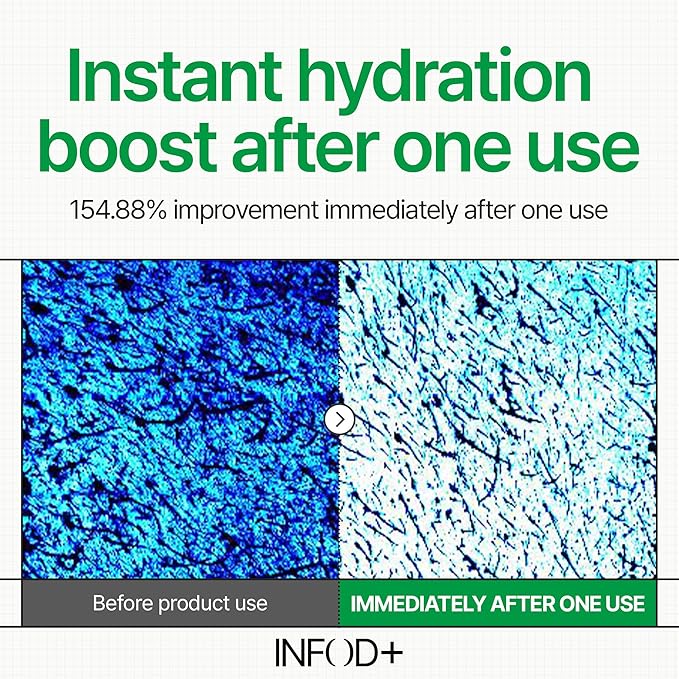 INFODPLUS HydroVita Cooling Gel Toner Pads, 70 Count – Korean Hydrating & Calming Facial Pads for Men & Women with Exosome & Ceramide, Oil Control, Gentle Pore Care, Fragrance-Free for Sensitive Skin