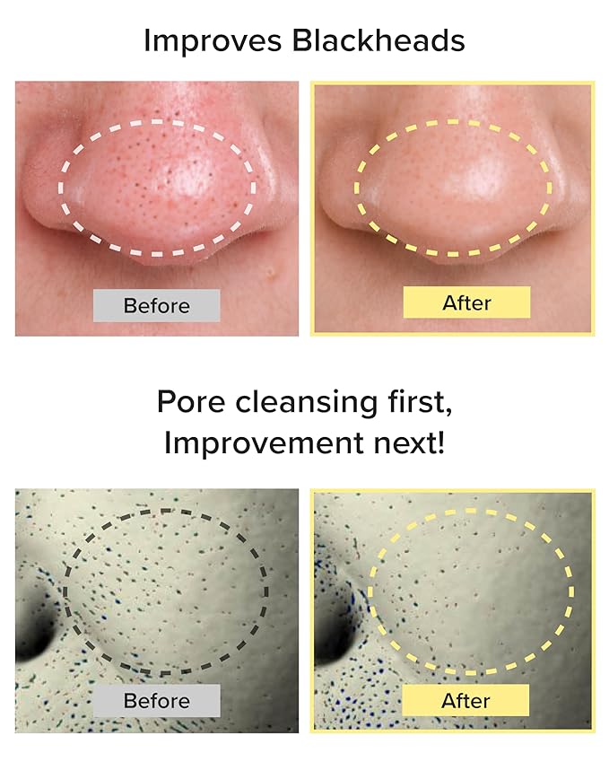 3W8L Deep Off & Fresh Cleansing Oil – Fast emulsifying Korean pore care cleanser, gentle daily makeup & sunscreen remover with Jojoba & Centella, dissolves sebum & blackheads, hydrating fresh finish