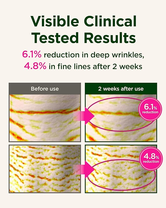 CKD Retino Collagen Gua Sha Neck Cream [Refill] - Firming Cream for Neck and Jawline Tightening, Lifting, and Wrinkle Reduction without Stainless Steel Roller. Korean Skin Care,1.69 fl oz.