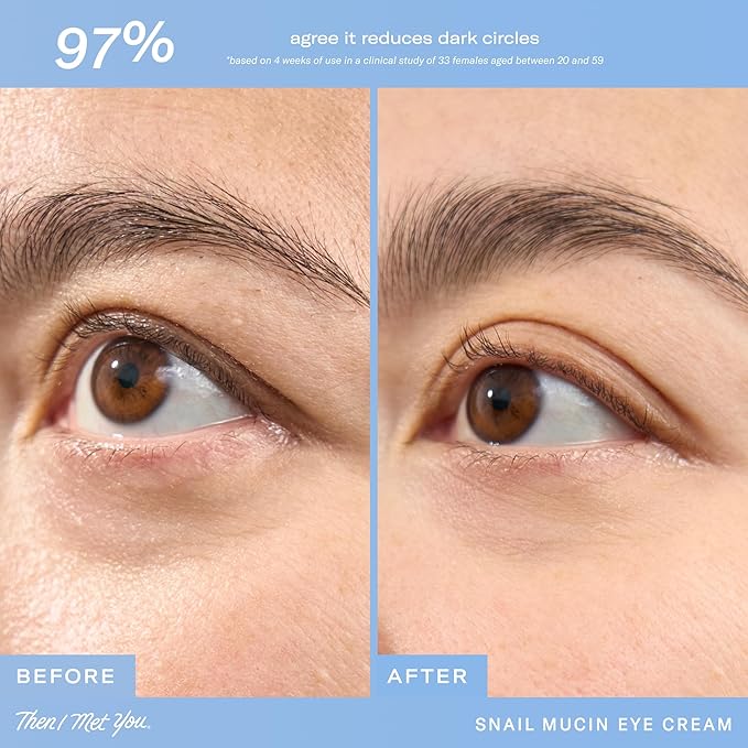 Then I Met You Snail Mucin Eye Cream, Korean Skincare for Dark Circles, Puffy Eyes, Fine Lines & Dehydrated Skin, Firming, Brightening and Plumping Treatment with Volufiline* & Caffeine, 0.51 oz